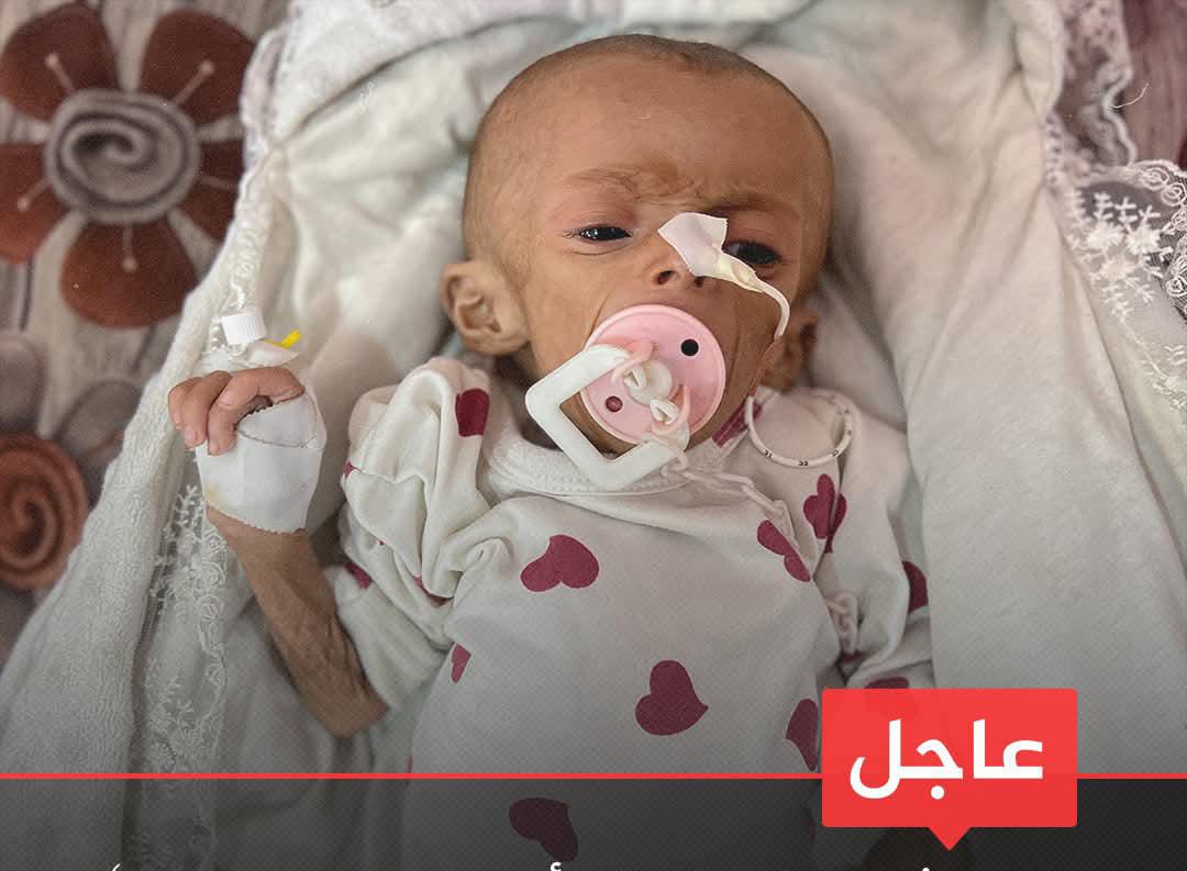 رئيس شبكة المنظمات الأهلية في غزة للجزيرة: أكثر من 50 ألف طفل رضيع محرومون من الرضاعة الطبيعية في القطاع